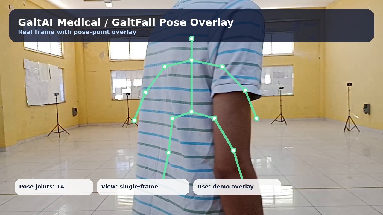 Medical gait pose overlay